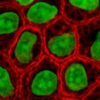 180pxepithelialcells_4